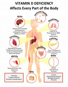 Interactive PDF: How Vitamin D Deficiency Affects Every Part of the ...