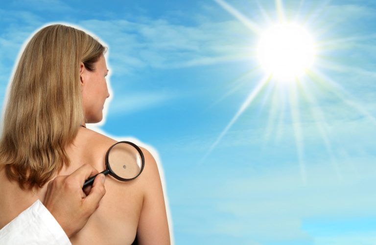 The Real Relationship between Skin Cancer, Sunshine and Vitamin D 